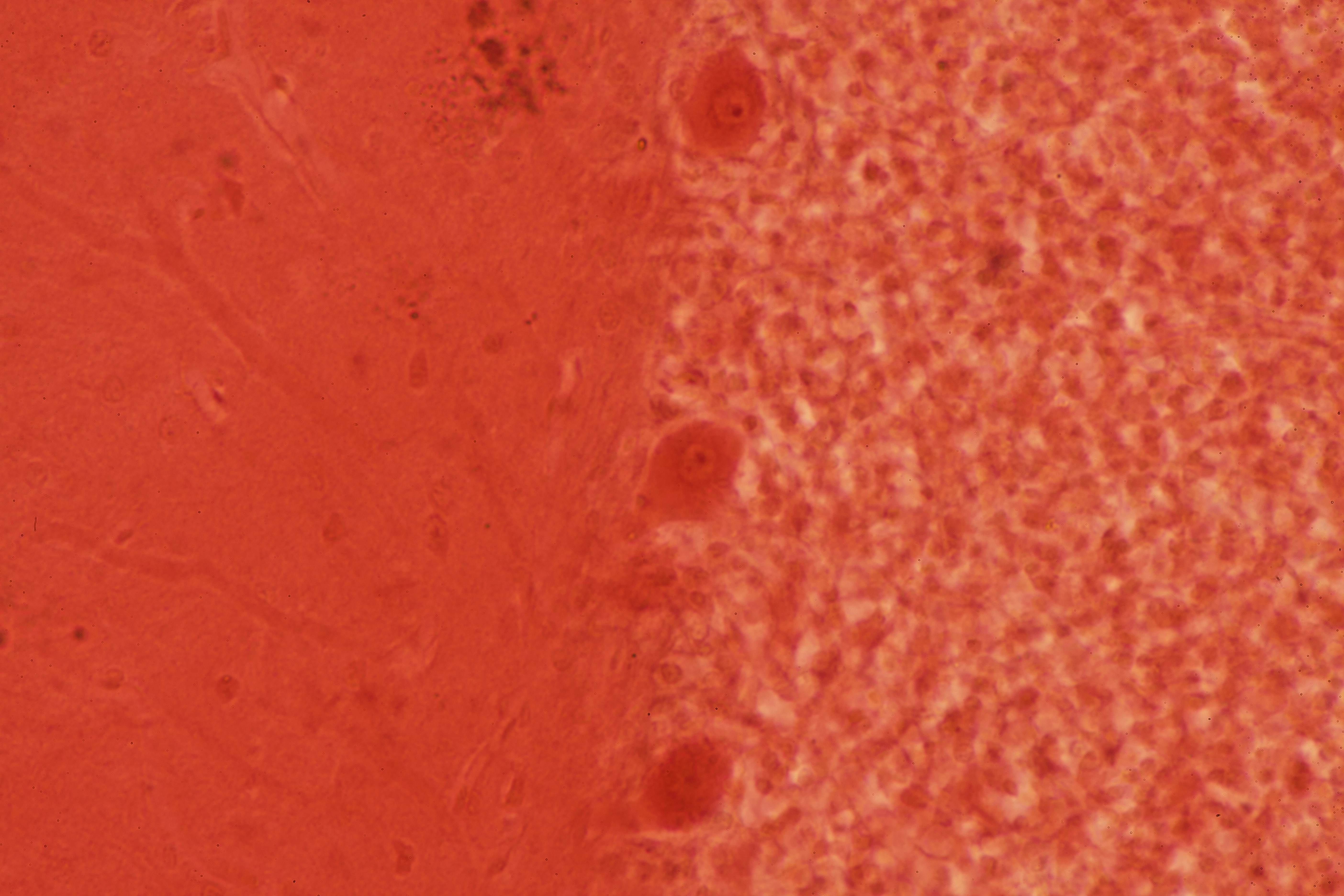 Brainstem