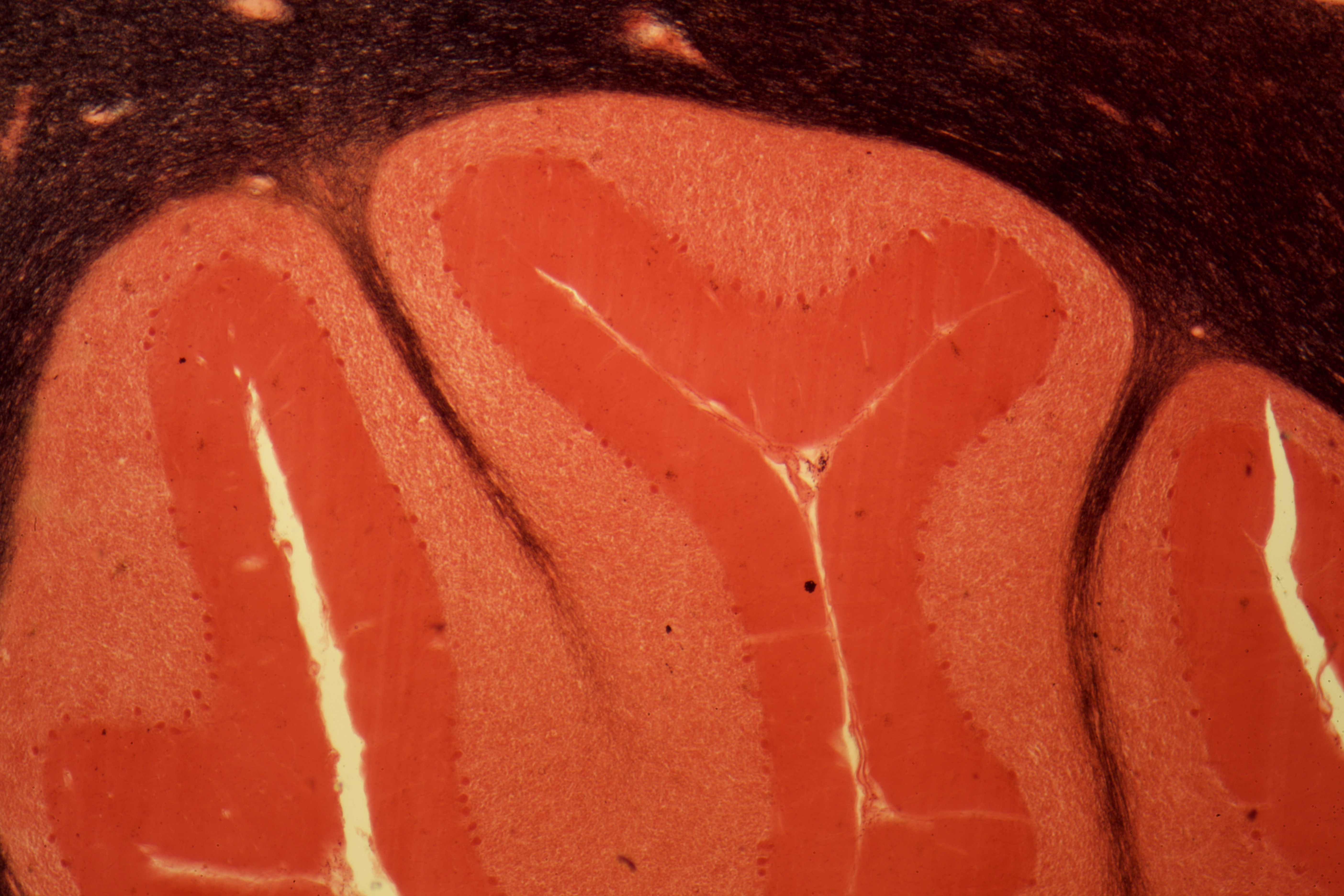 Brainstem