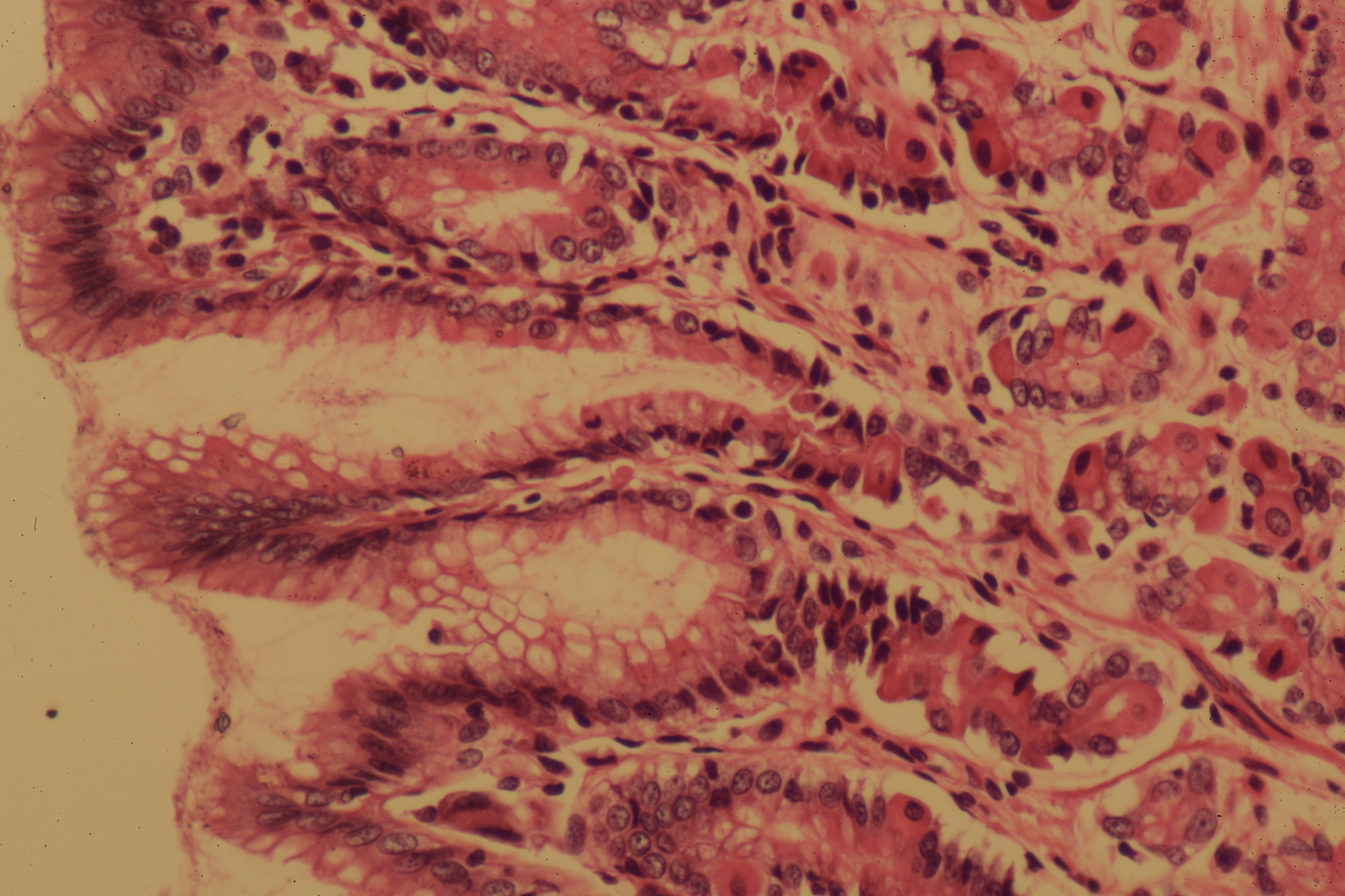 Gastric Mucosa