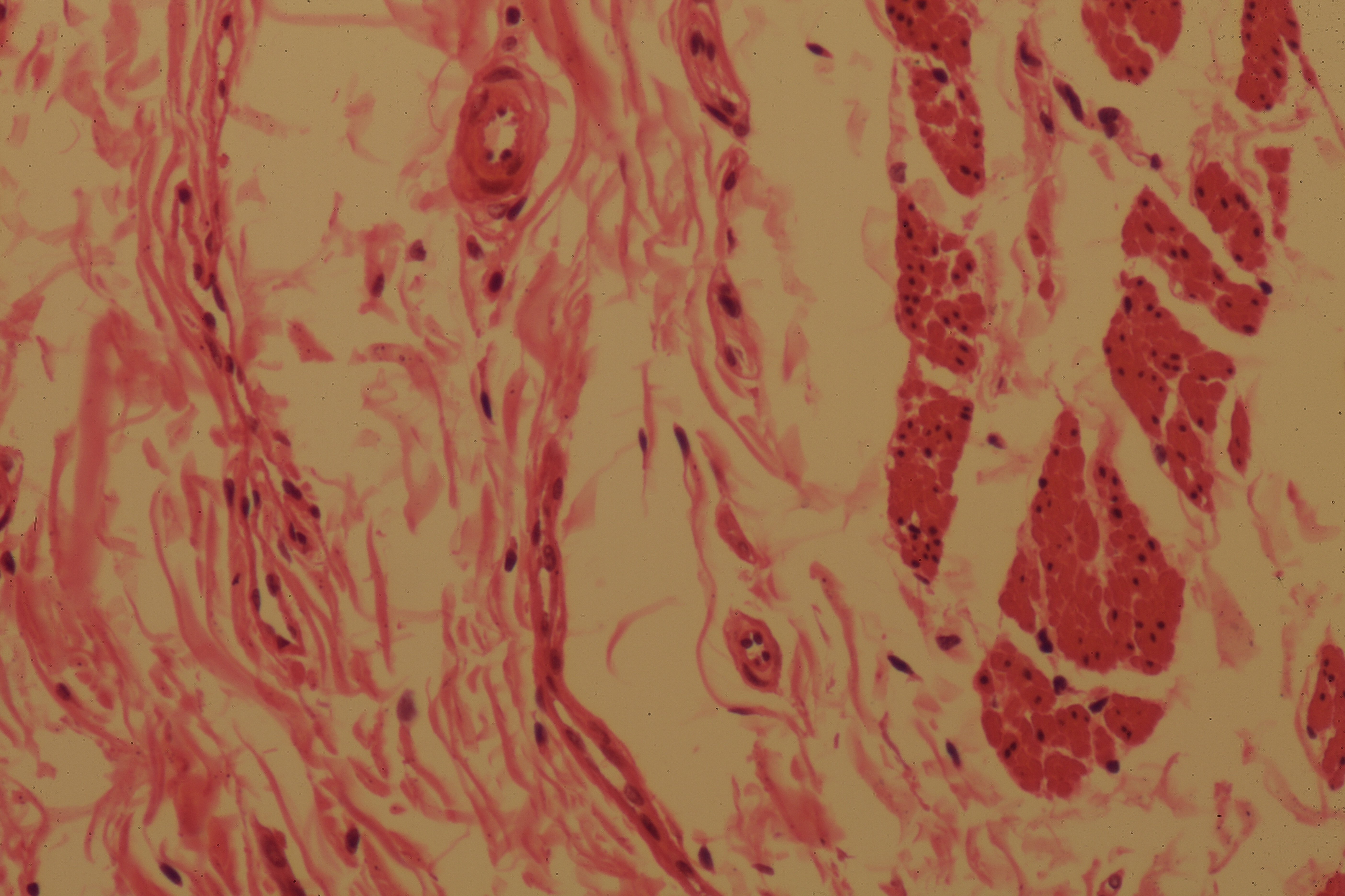 Gastric Mucosa