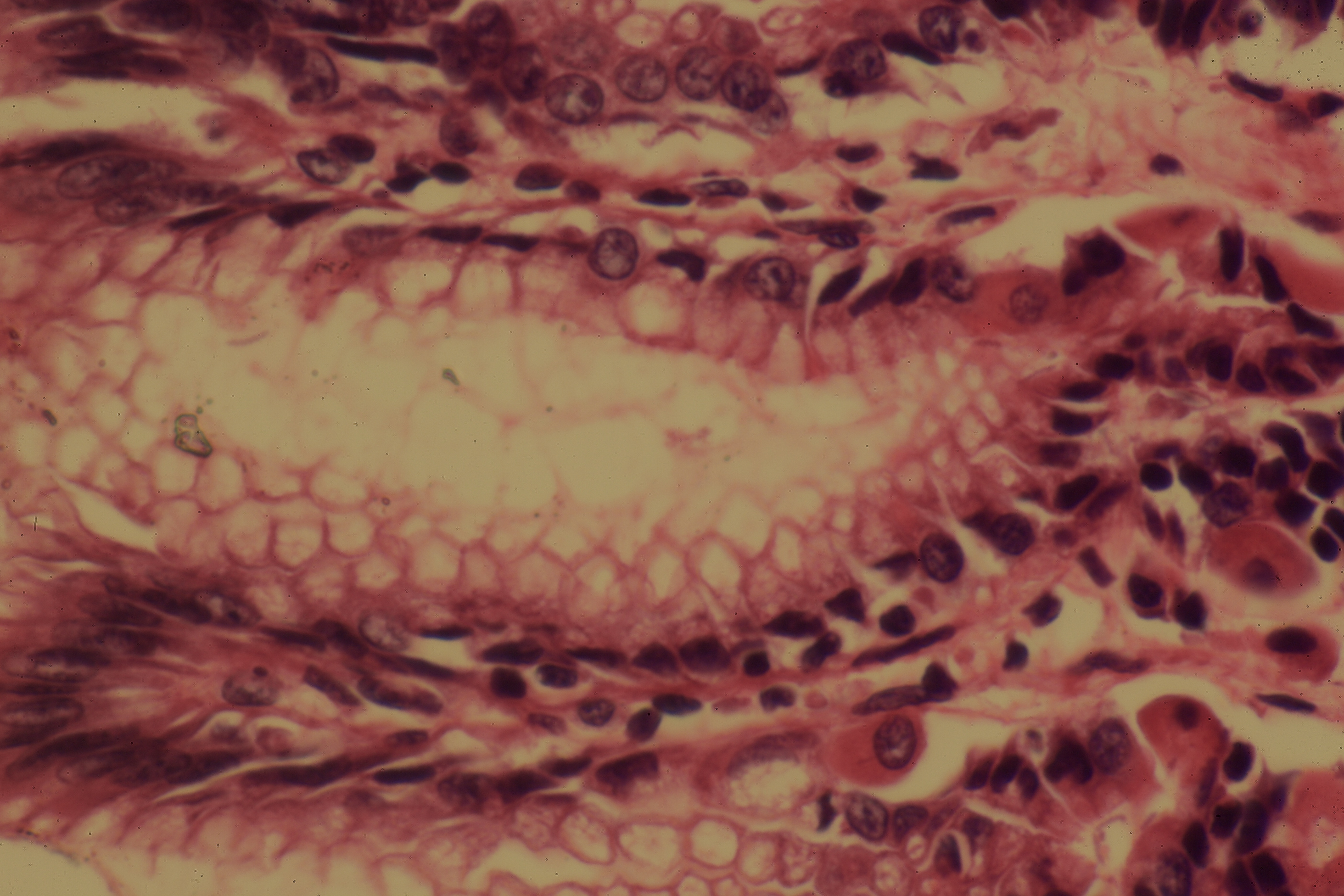Gastric Mucosa