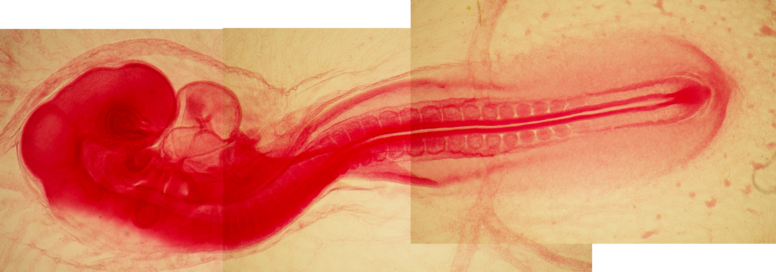 Chicken Embryo