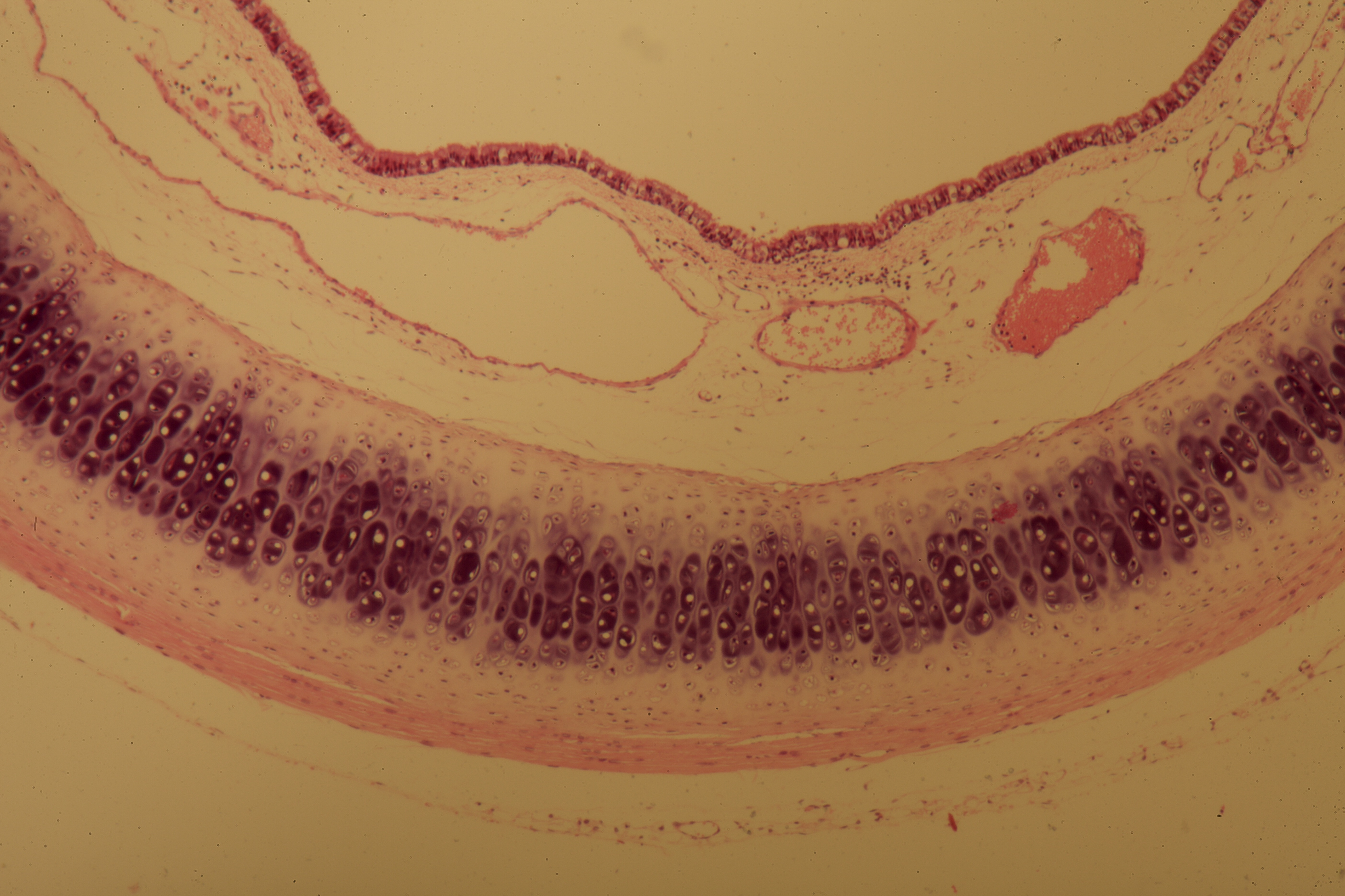 Motor Nerve